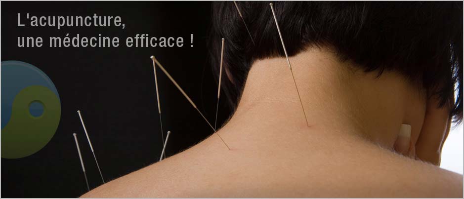 acupuncture repentigny