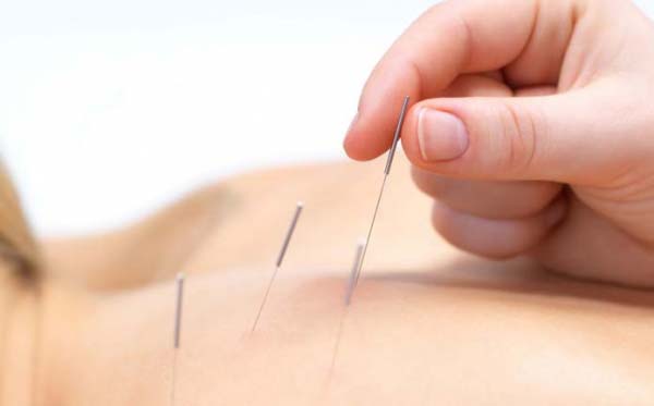 Traitement en acupuncture