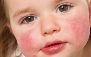 L’acupuncture pour les enfants et les bébés